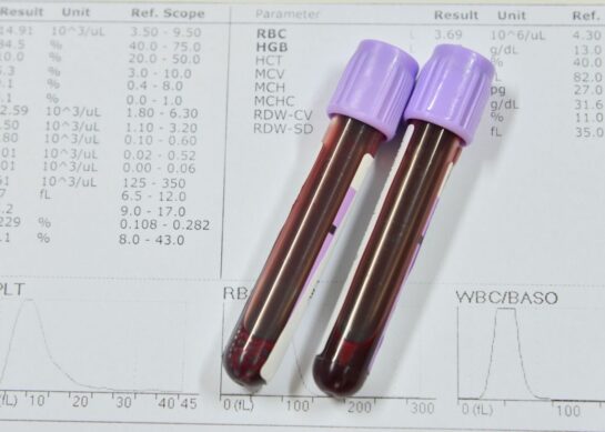 Mchc в анализе крови